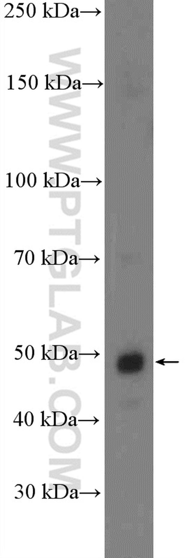 NFKB1 p105/p50 Antibody in Western Blot (WB)