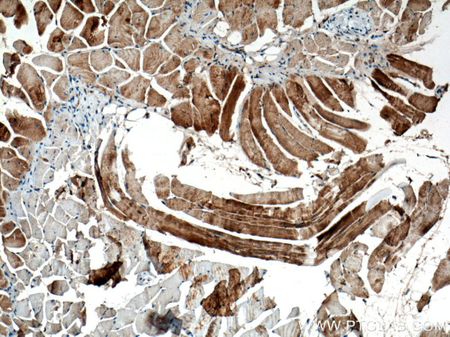 ACTN2 Antibody in Immunohistochemistry (Paraffin) (IHC (P))