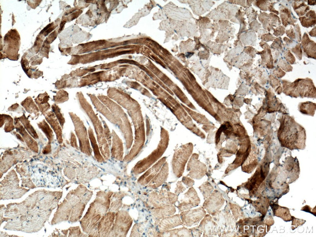 ACTN2 Antibody in Immunohistochemistry (Paraffin) (IHC (P))