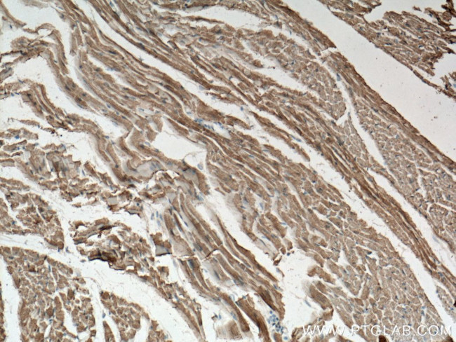 ACTN2 Antibody in Immunohistochemistry (Paraffin) (IHC (P))