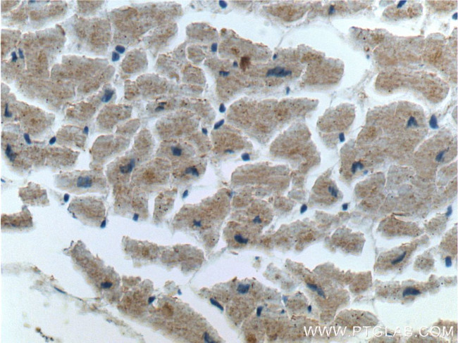 ACTN2 Antibody in Immunohistochemistry (Paraffin) (IHC (P))