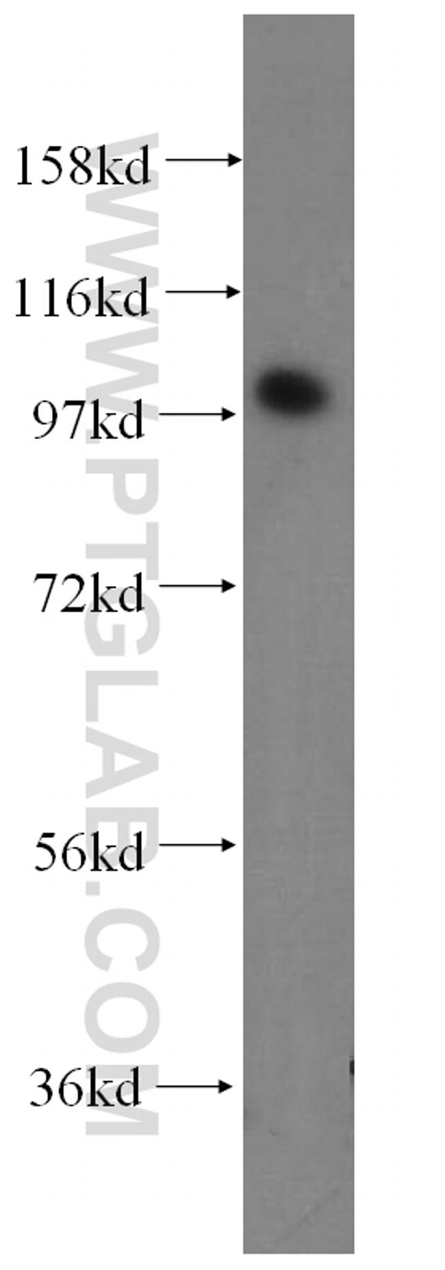 ACTN2 Antibody in Western Blot (WB)