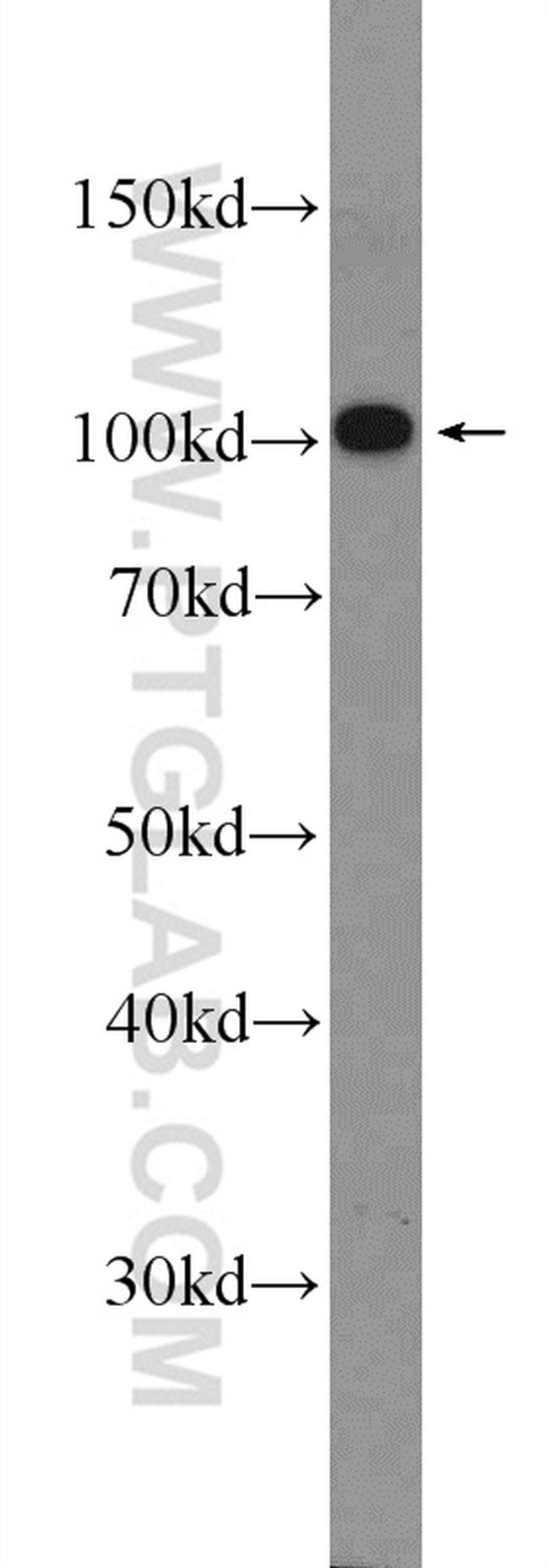 ACTN2 Antibody in Western Blot (WB)