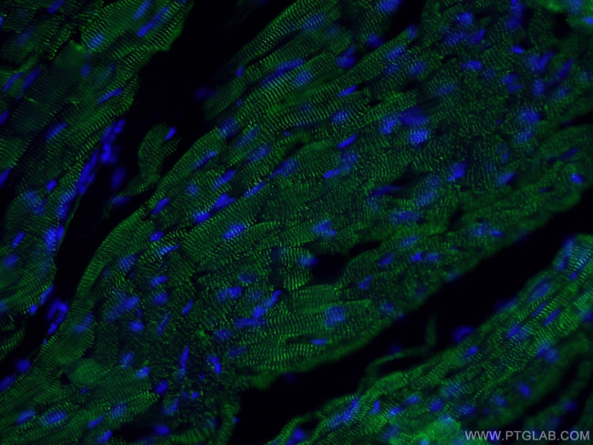 ACTN2 Antibody in Immunohistochemistry (PFA fixed) (IHC (PFA))