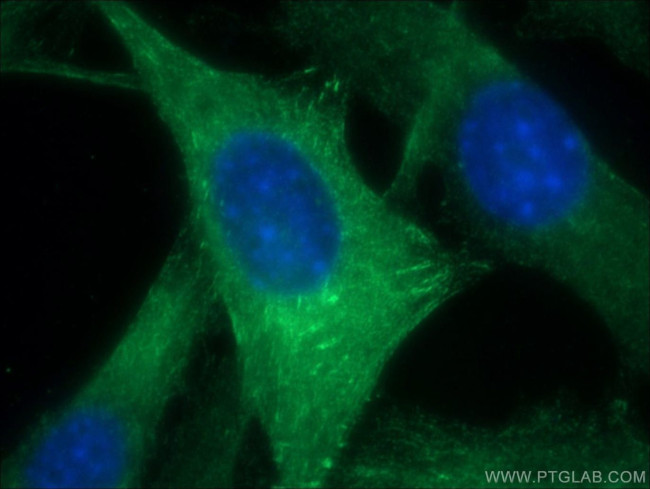 ACTN2 Antibody in Immunocytochemistry (ICC/IF)