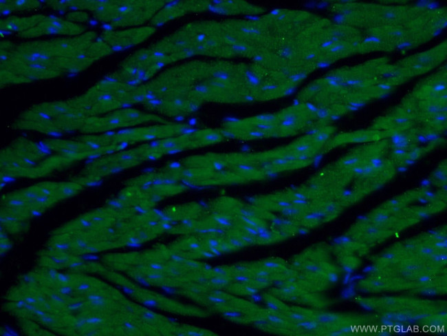 ACTN2 Antibody in Immunohistochemistry (PFA fixed) (IHC (PFA))