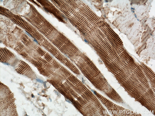 ACTN2 Antibody in Immunohistochemistry (Paraffin) (IHC (P))