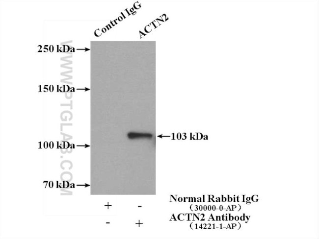 ACTN2 Antibody in Immunoprecipitation (IP)