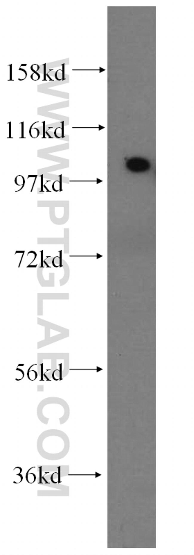 ACTN2 Antibody in Western Blot (WB)