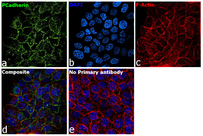 P-Cadherin Antibody in Immunocytochemistry (ICC/IF)