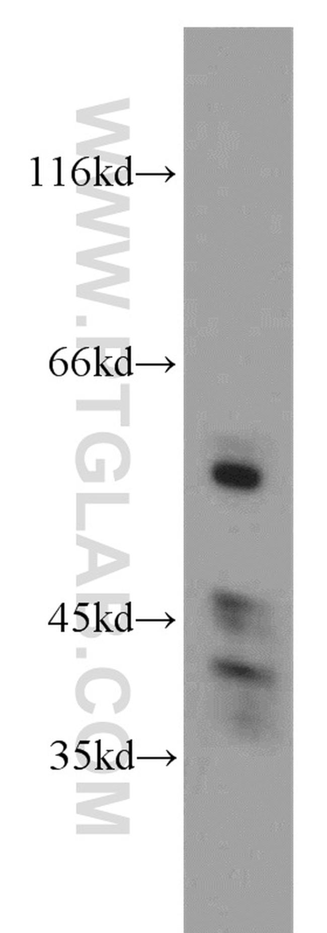 STAU1 Antibody in Western Blot (WB)