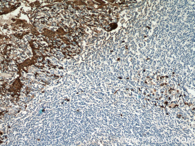 S100A9 Antibody in Immunohistochemistry (Paraffin) (IHC (P))