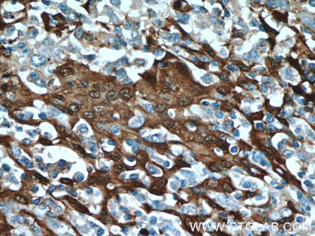 S100A9 Antibody in Immunohistochemistry (Paraffin) (IHC (P))