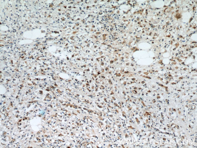 S100A9 Antibody in Immunohistochemistry (Paraffin) (IHC (P))