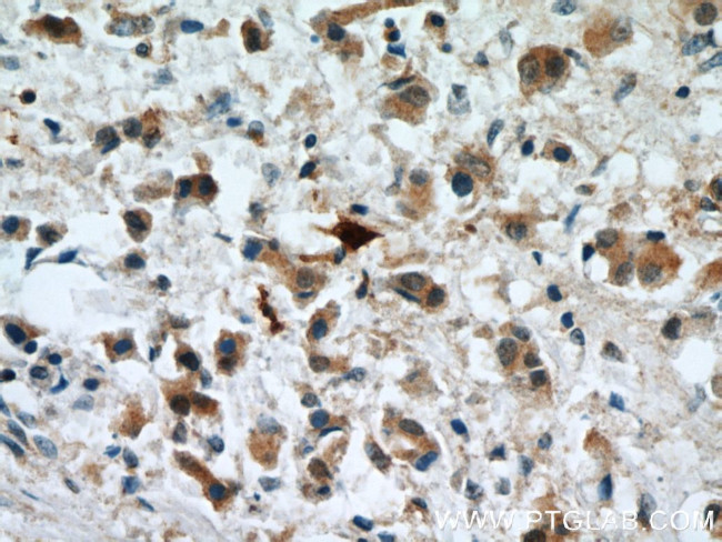 S100A9 Antibody in Immunohistochemistry (Paraffin) (IHC (P))