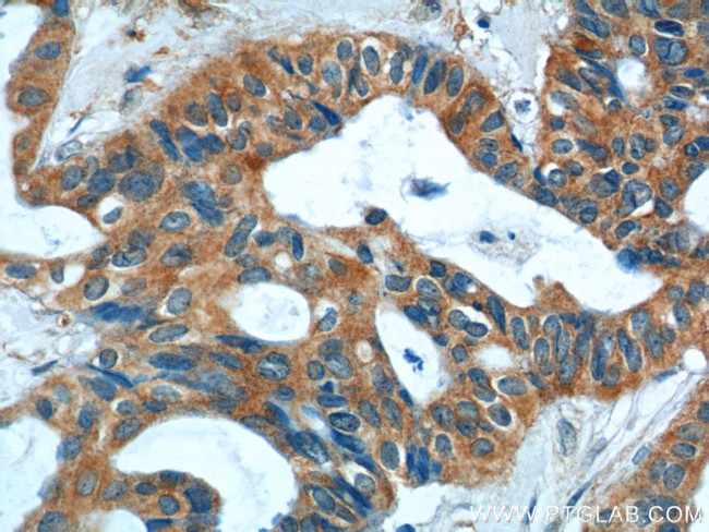 S100A9 Antibody in Immunohistochemistry (Paraffin) (IHC (P))