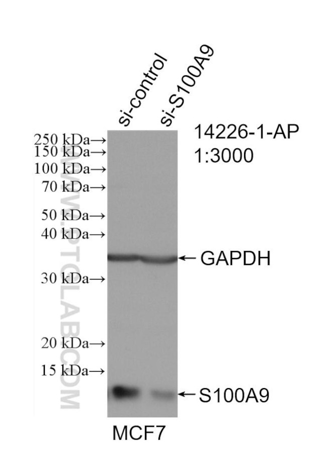 S100A9 Antibody in Western Blot (WB)