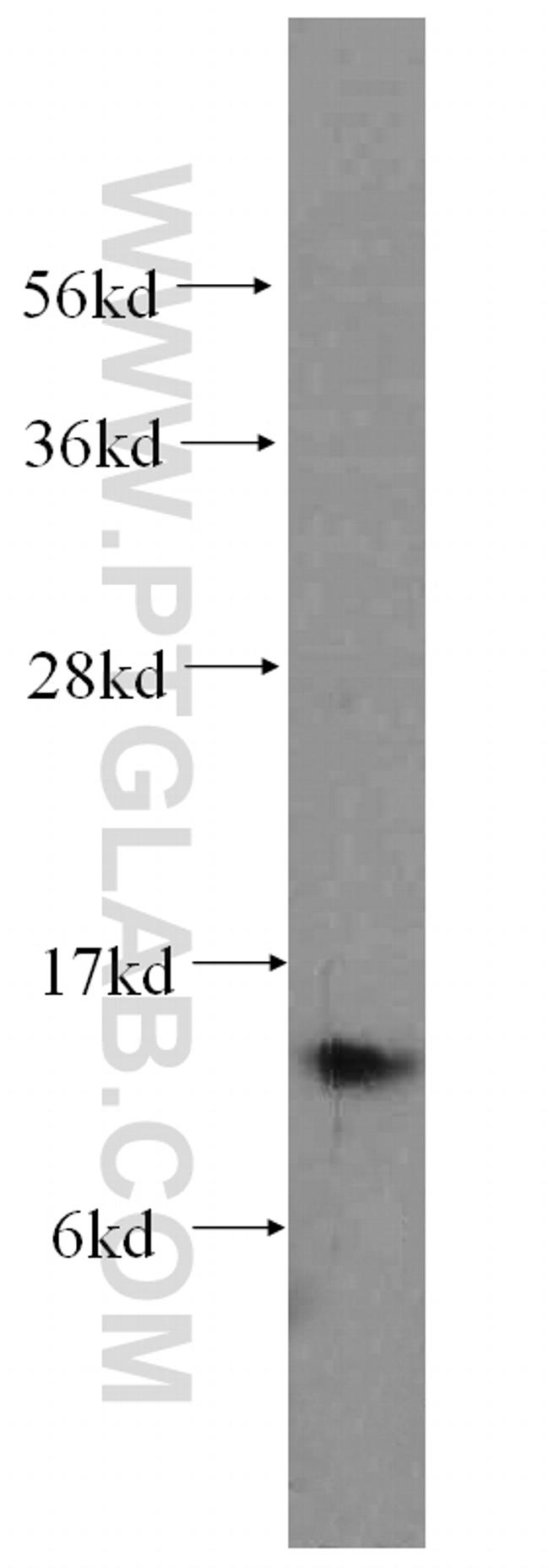 S100A9 Antibody in Western Blot (WB)