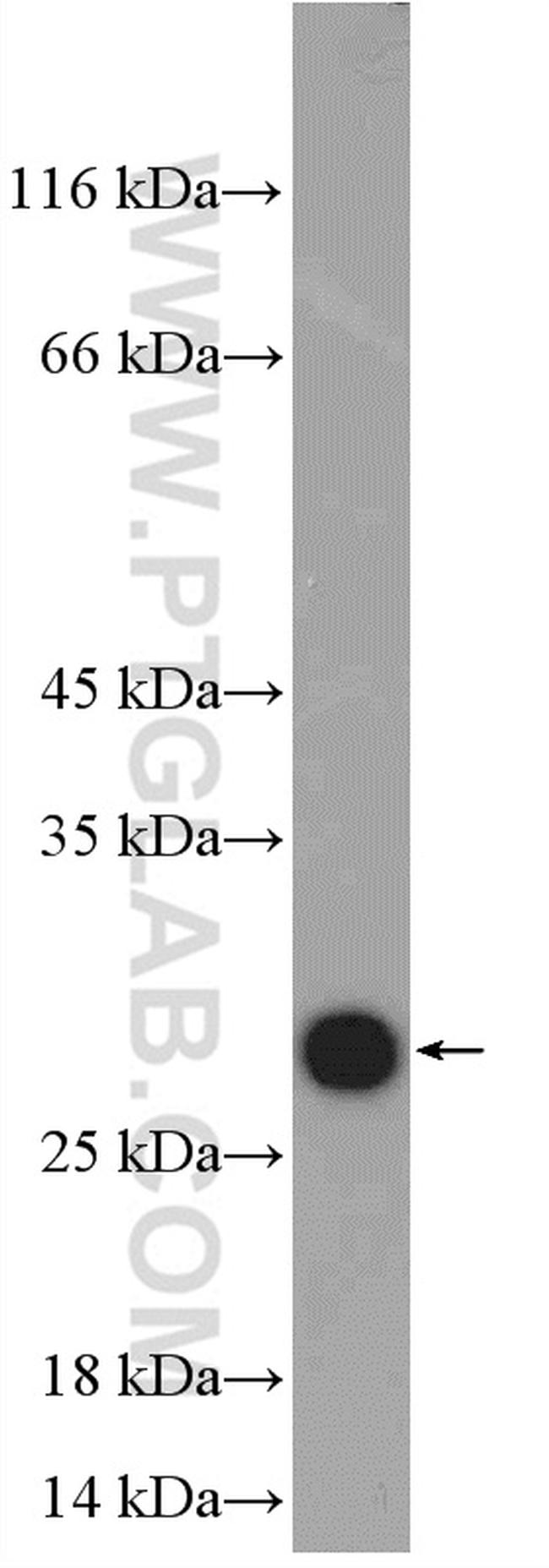 S100A9 Antibody in Western Blot (WB)