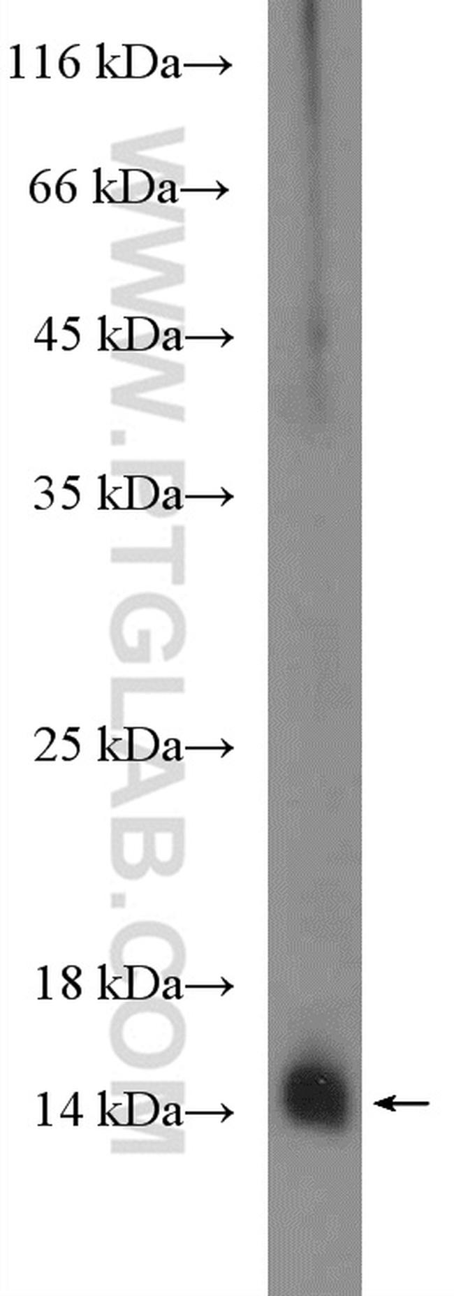 S100A9 Antibody in Western Blot (WB)