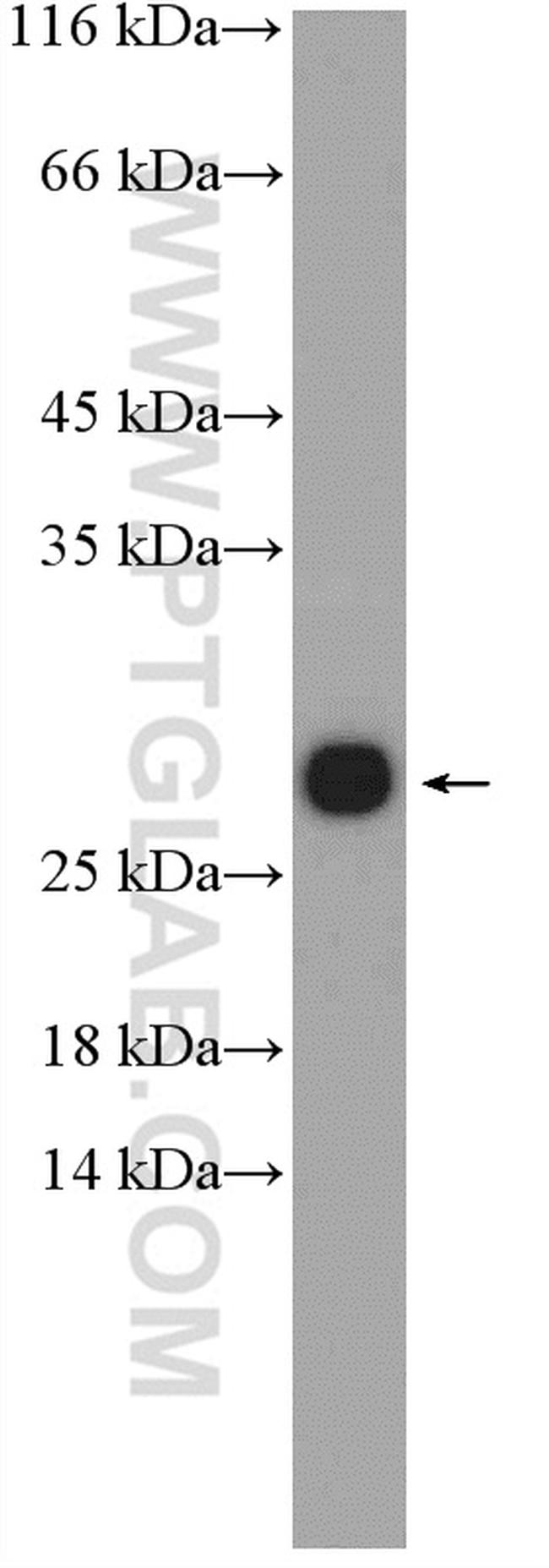 S100A9 Antibody in Western Blot (WB)