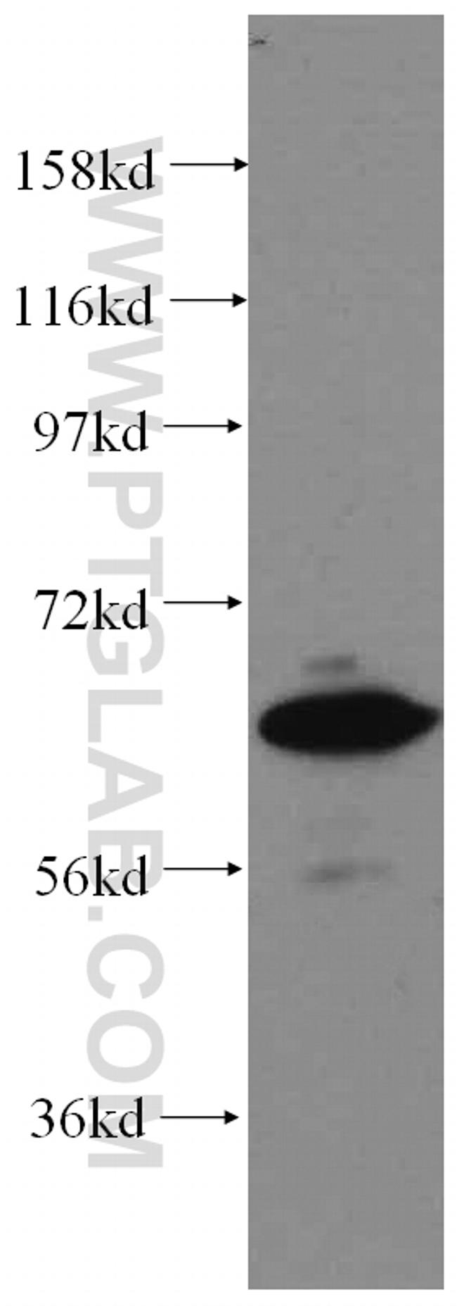 STXBP4 Antibody in Western Blot (WB)