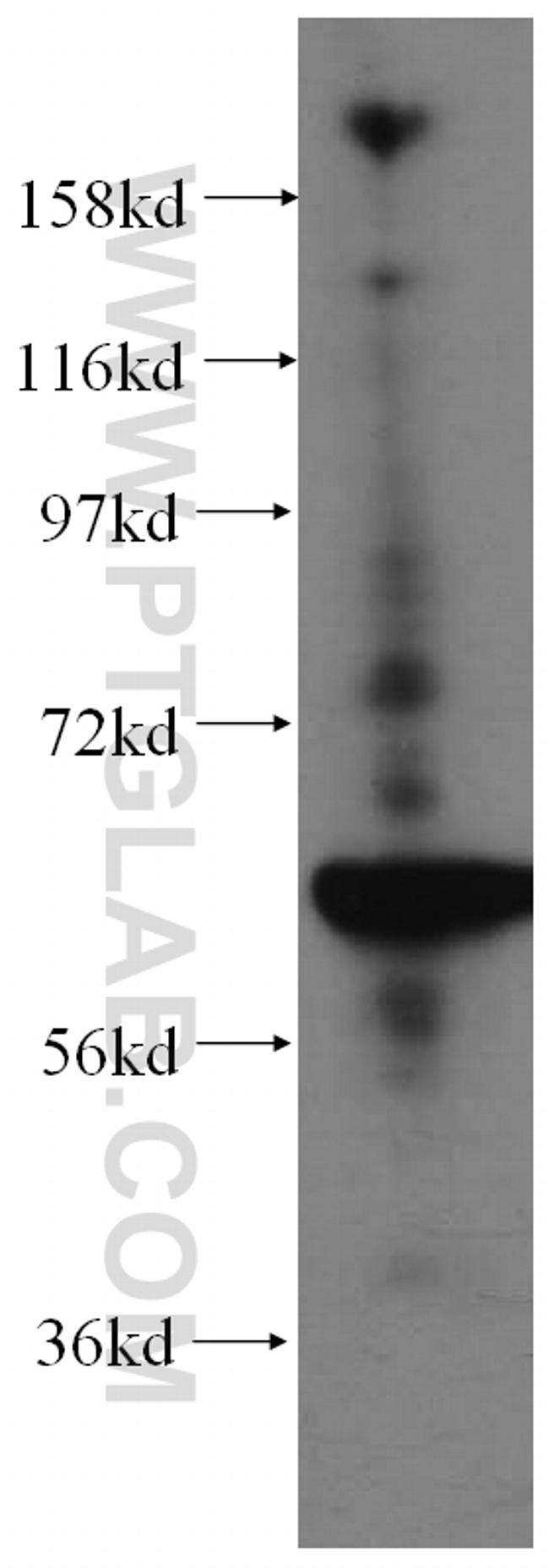 STXBP4 Antibody in Western Blot (WB)