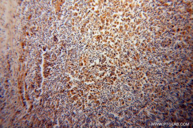 STXBP4 Antibody in Immunohistochemistry (Paraffin) (IHC (P))