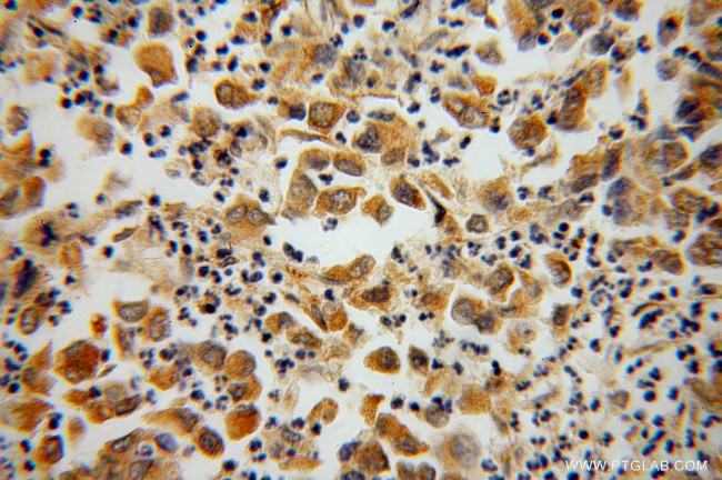 STXBP4 Antibody in Immunohistochemistry (Paraffin) (IHC (P))