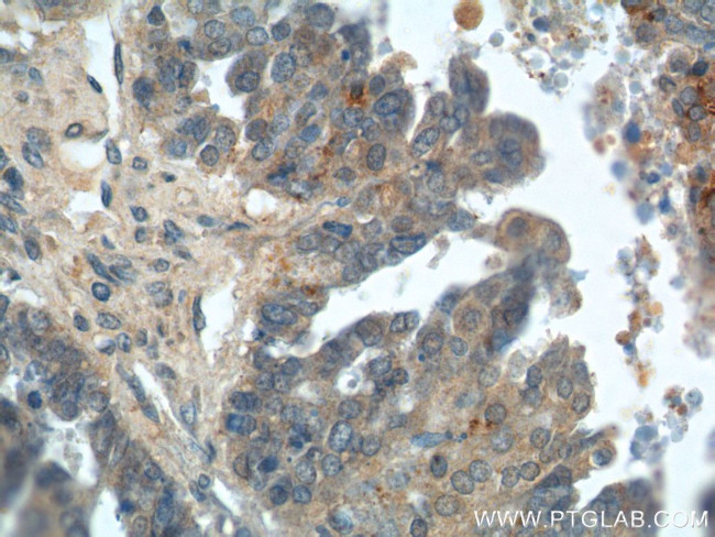 Kallikrein 8 Antibody in Immunohistochemistry (Paraffin) (IHC (P))