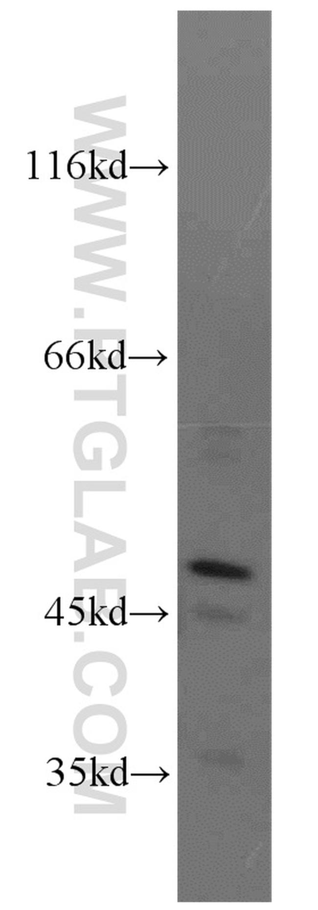 NEK2 Antibody in Western Blot (WB)