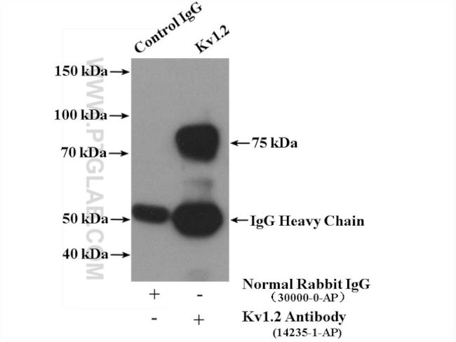 Kv1.2 Antibody in Immunoprecipitation (IP)