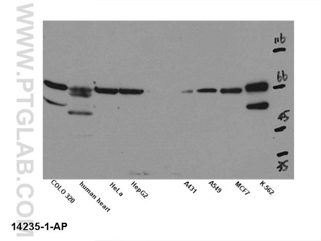 Kv1.2 Antibody in Western Blot (WB)