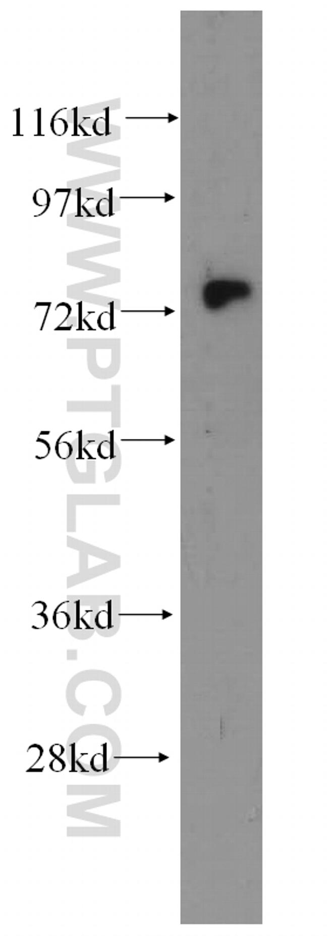 Kv1.2 Antibody in Western Blot (WB)