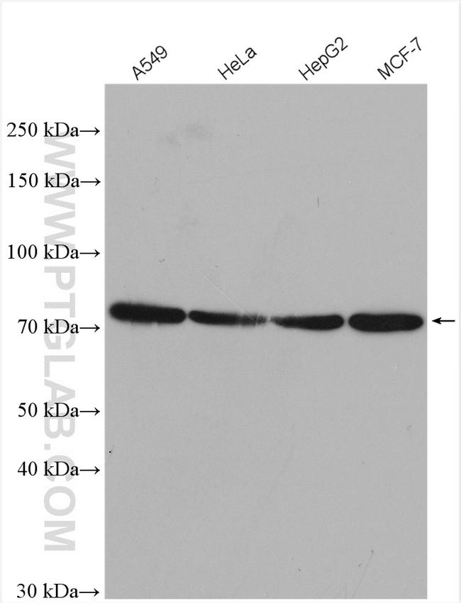 Kv1.2 Antibody in Western Blot (WB)