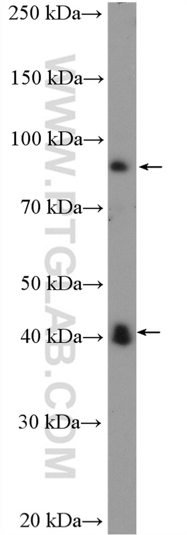 LIV-1/ZIP6 Antibody in Western Blot (WB)