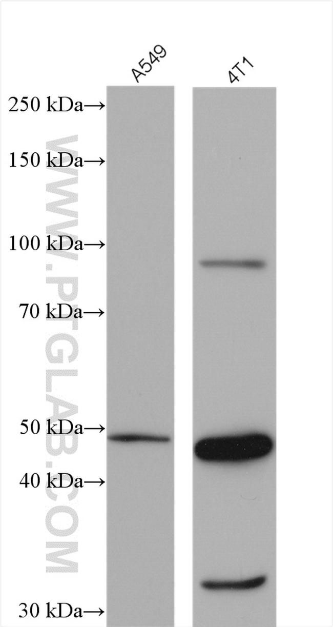 LIV-1/ZIP6 Antibody in Western Blot (WB)