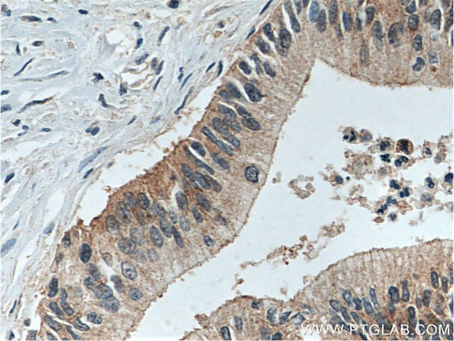 LIV-1/ZIP6 Antibody in Immunohistochemistry (Paraffin) (IHC (P))