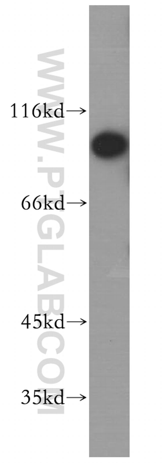 LIV-1/ZIP6 Antibody in Western Blot (WB)