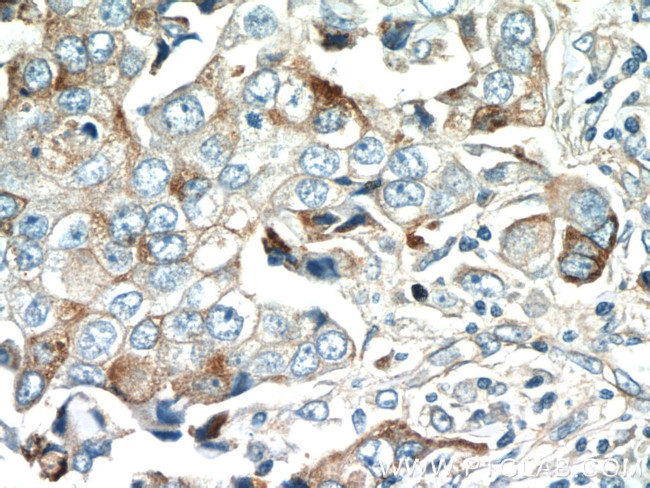 DUSP16 Antibody in Immunohistochemistry (Paraffin) (IHC (P))