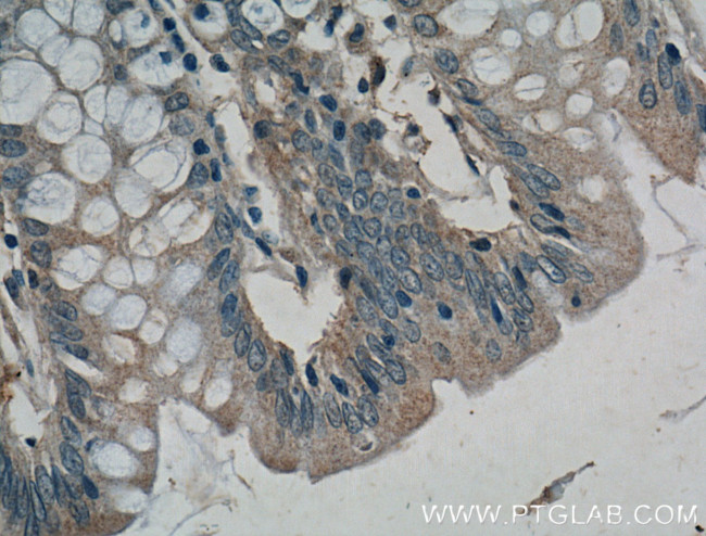 DUSP16 Antibody in Immunohistochemistry (Paraffin) (IHC (P))