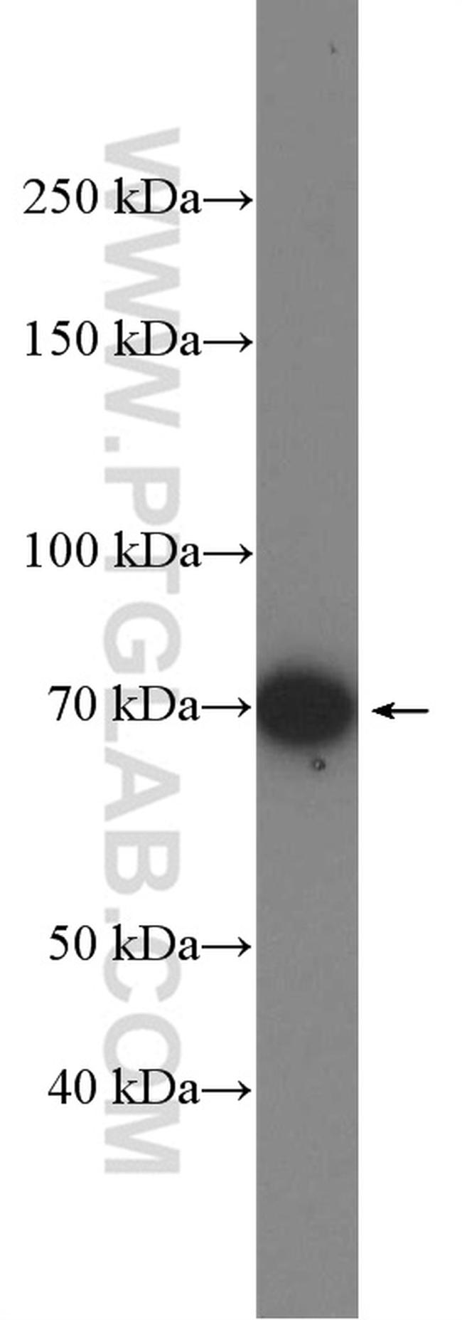 DUSP16 Antibody in Western Blot (WB)