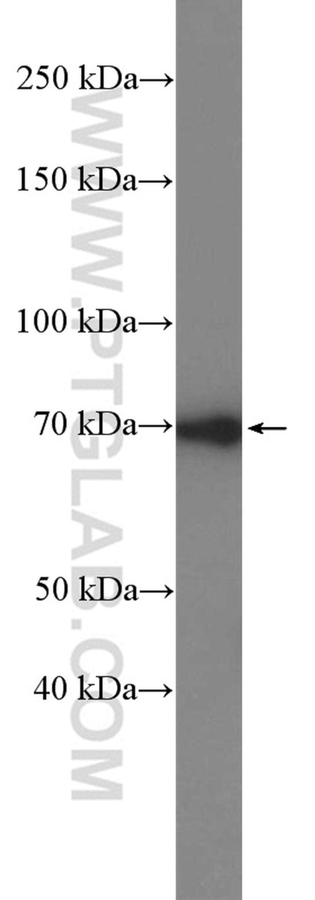 DUSP16 Antibody in Western Blot (WB)