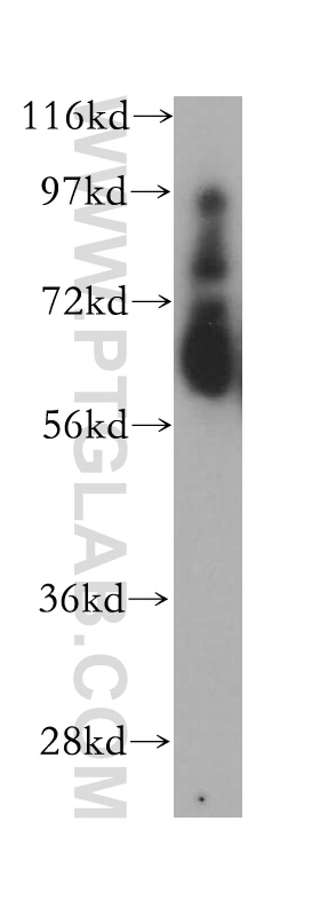 Myocilin Antibody in Western Blot (WB)