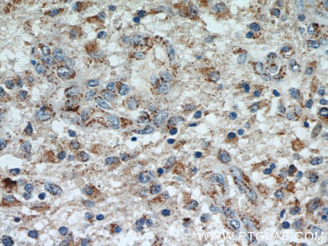 SUCLG2 Antibody in Immunohistochemistry (Paraffin) (IHC (P))