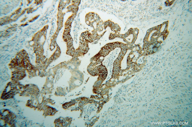 SUCLG2 Antibody in Immunohistochemistry (Paraffin) (IHC (P))