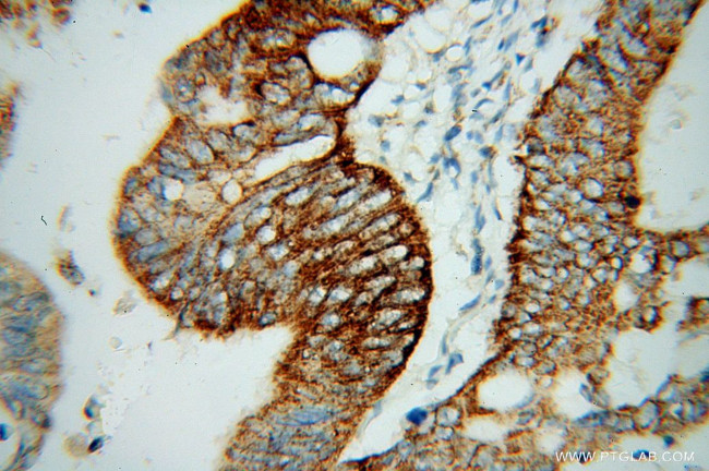 SUCLG2 Antibody in Immunohistochemistry (Paraffin) (IHC (P))