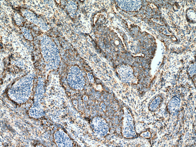 SUCLG2 Antibody in Immunohistochemistry (Paraffin) (IHC (P))