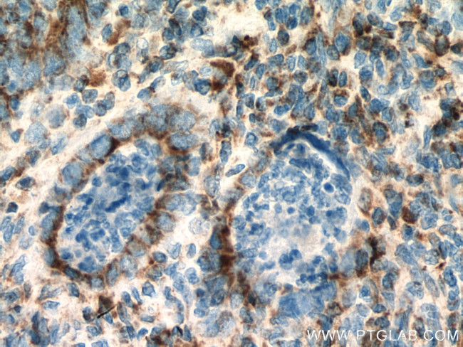 SUCLG2 Antibody in Immunohistochemistry (Paraffin) (IHC (P))