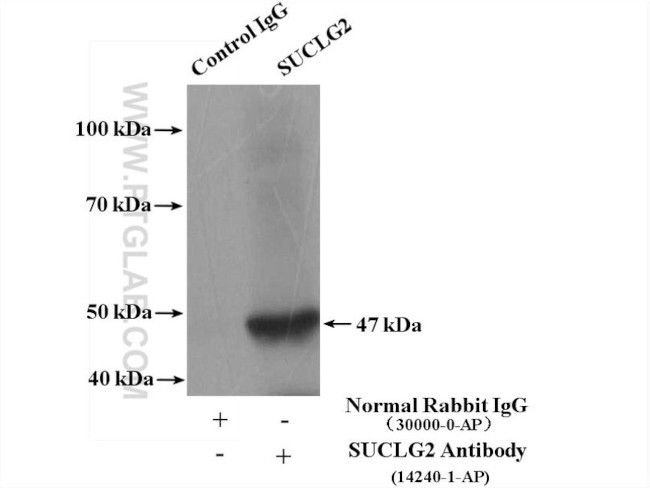 SUCLG2 Antibody in Immunoprecipitation (IP)